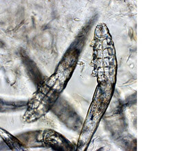 demodex